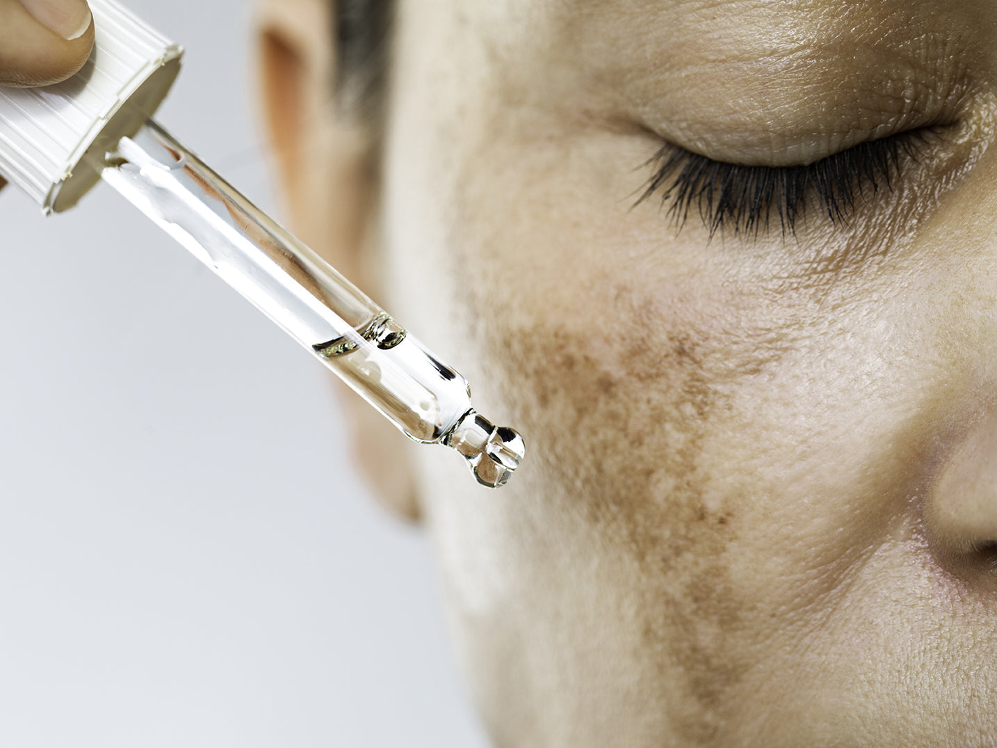 How To Soothe Sunburn and Reduce Redness Overnight